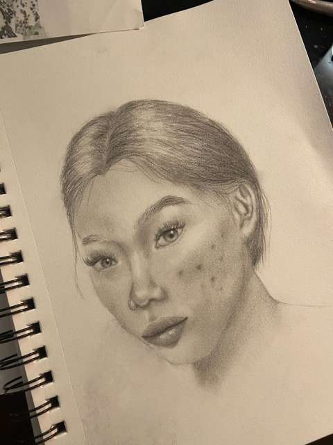 A sketch of a girl with acne marks on her cheeks.